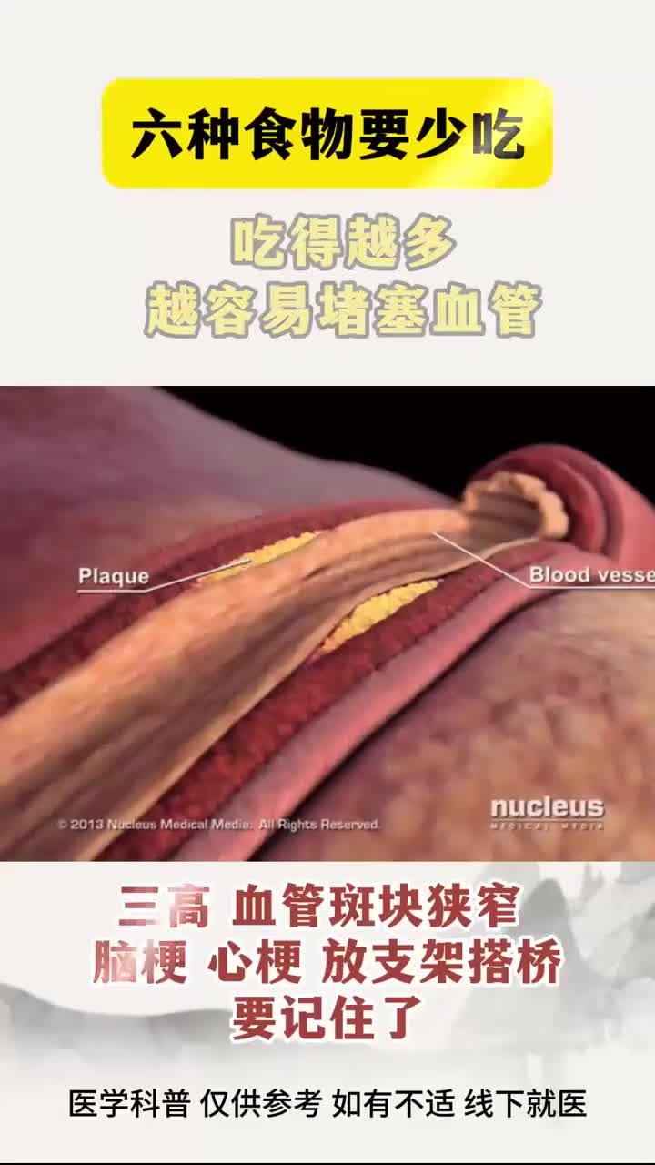 六种食物要少吃,吃的越容易堵塞血管!