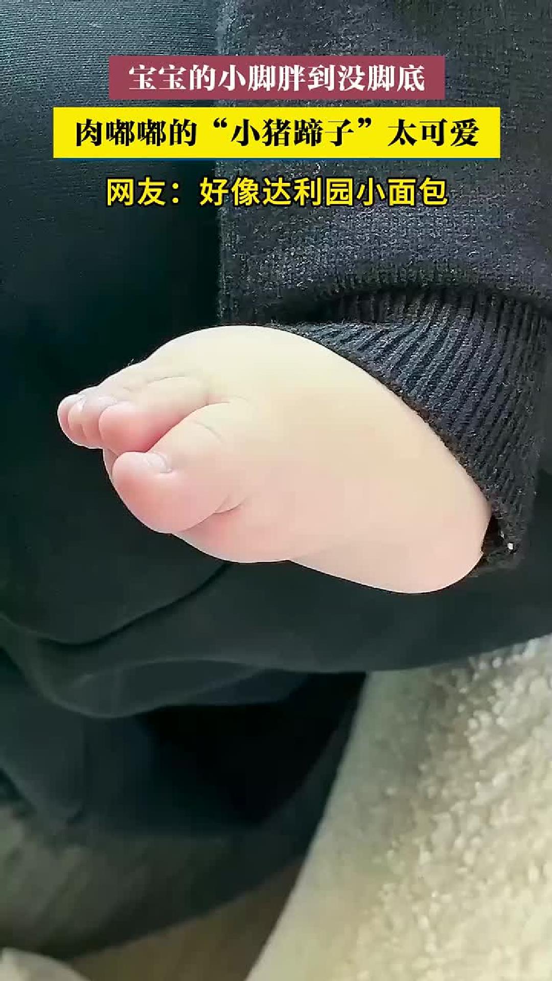 宝宝胖到没脚底，肉嘟嘟“小猪蹄子”太可爱。