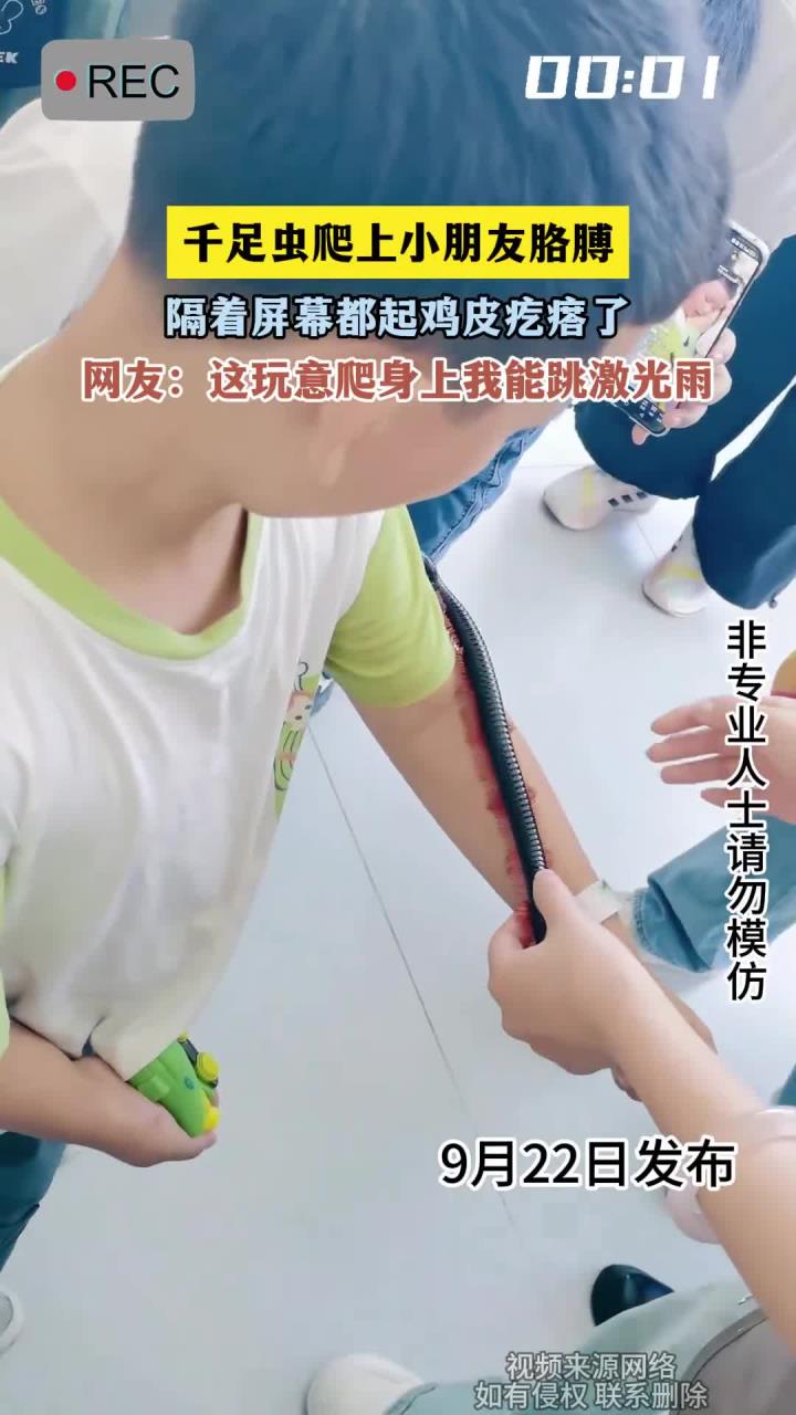 千足虫爬上小朋友胳膊,隔着屏幕都起鸡皮疙瘩了