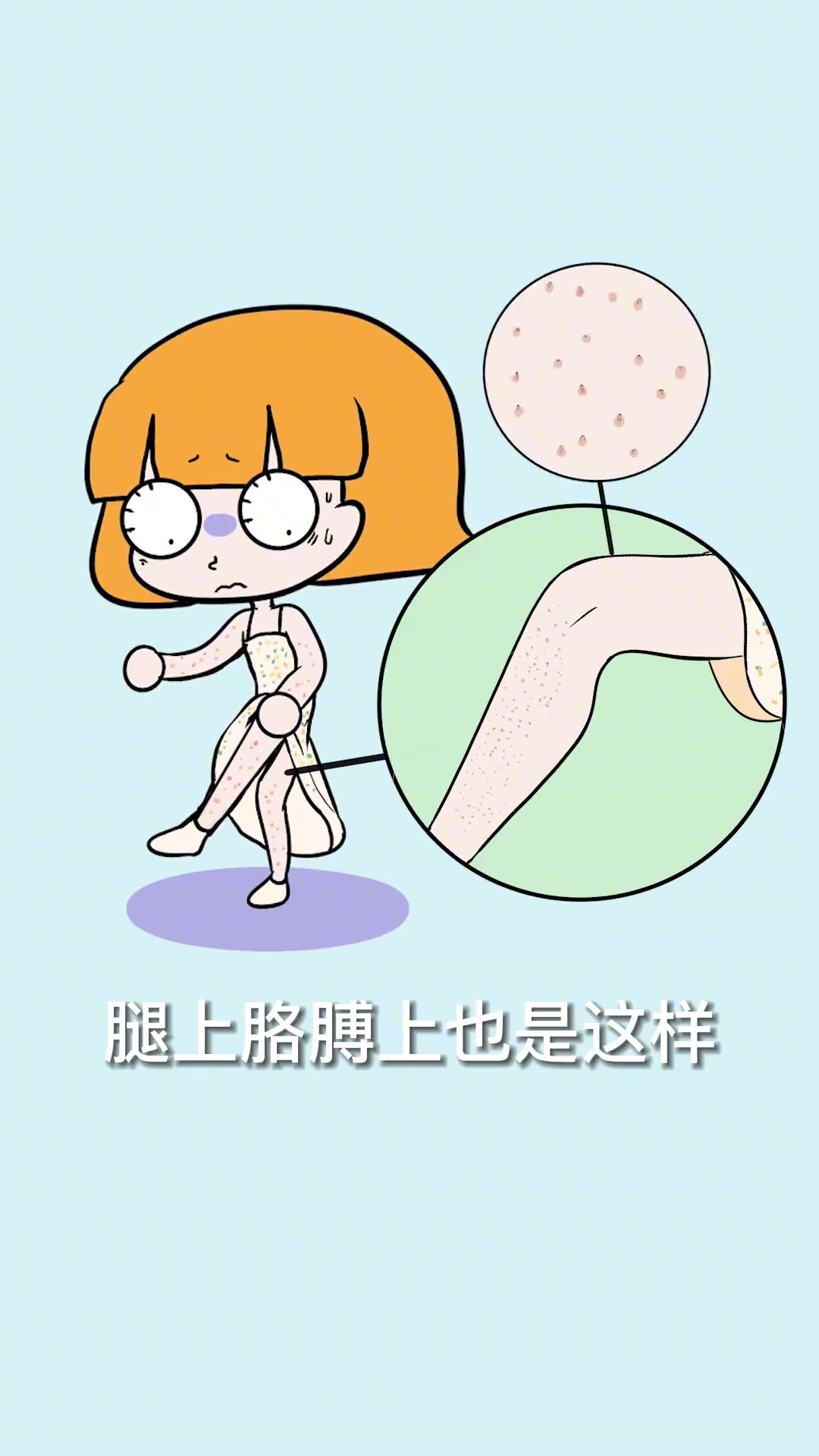 女生的皮肤上,为什么会有很多小疙瘩?