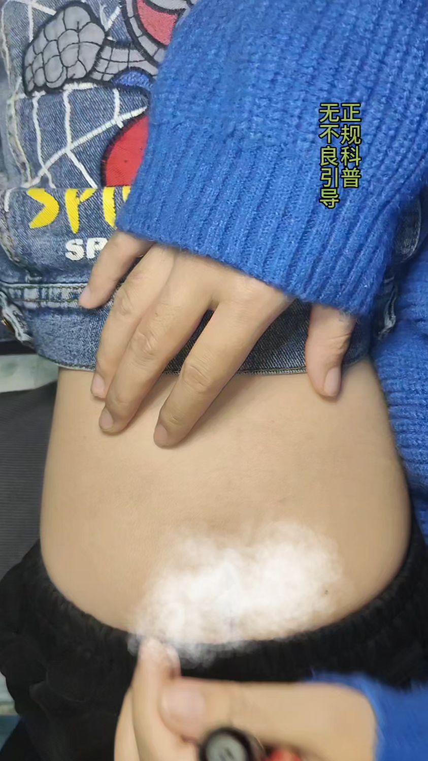 肌肉注射十子法连线