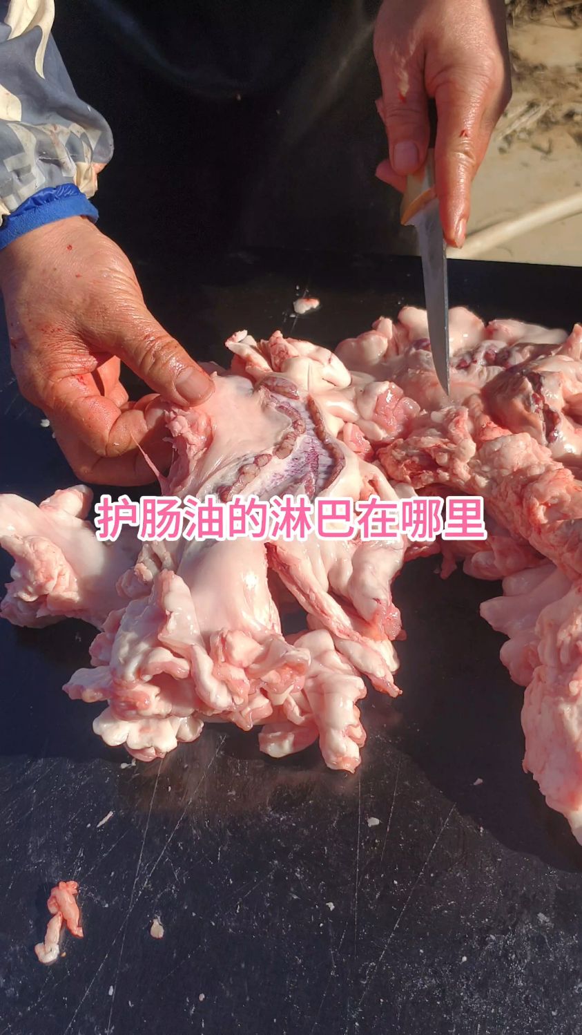 护肠油的淋巴到底在哪里