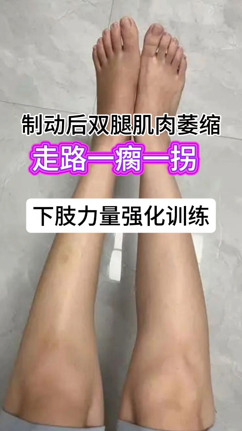 腿部制动肌肉萎缩抗阻力训练少不了