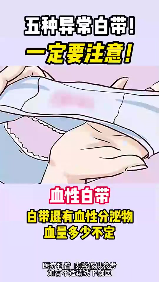 当出现这五种白带之一，一定要注意！！
