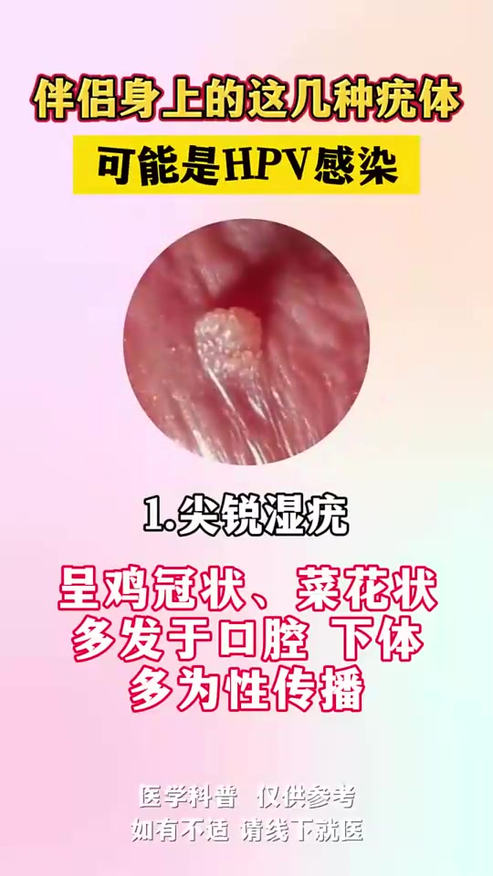 伴侣身上的这几种疣体,可能是HPV感染!