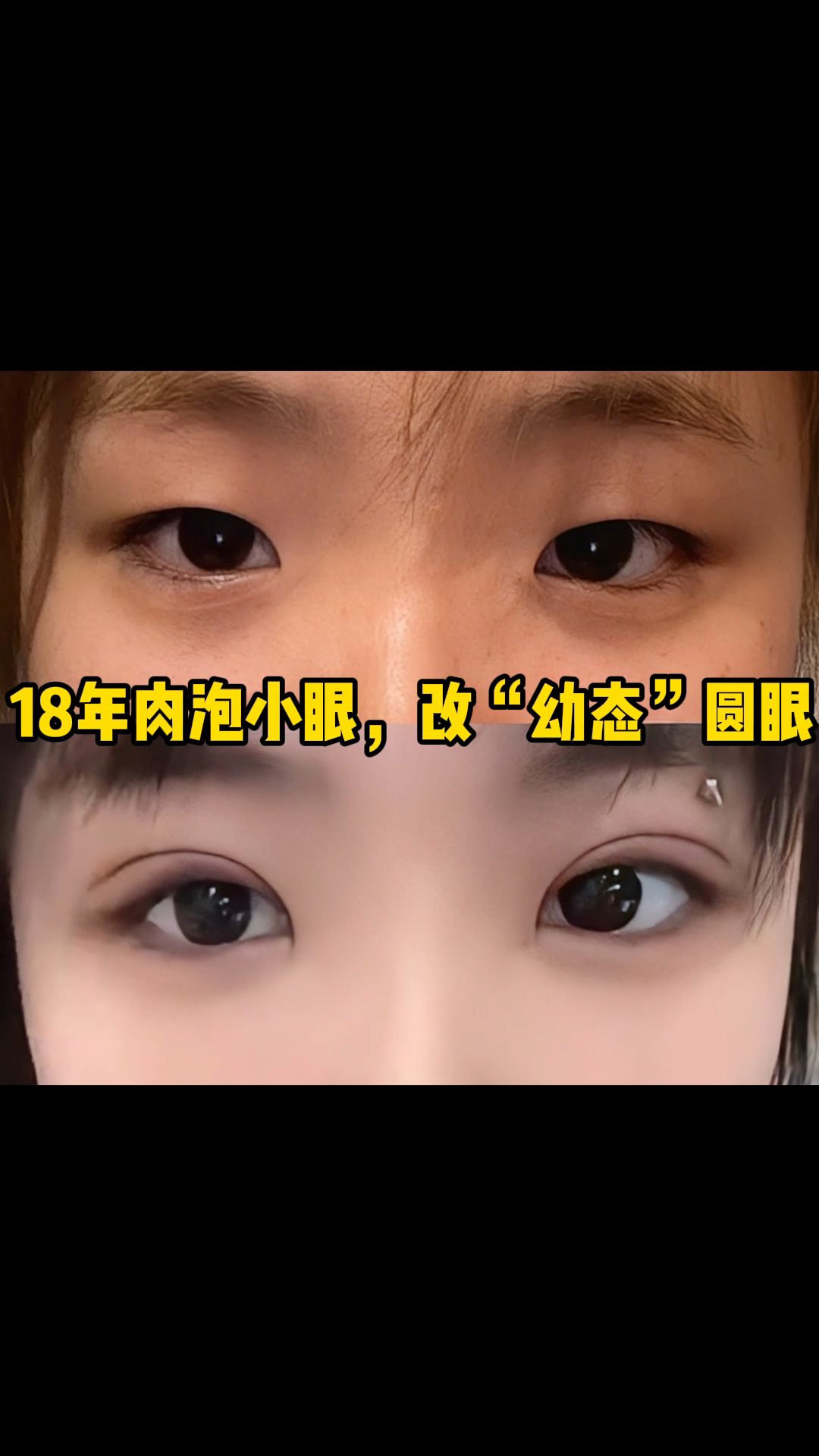 18年肉泡小眼,改“幼态”圆眼!