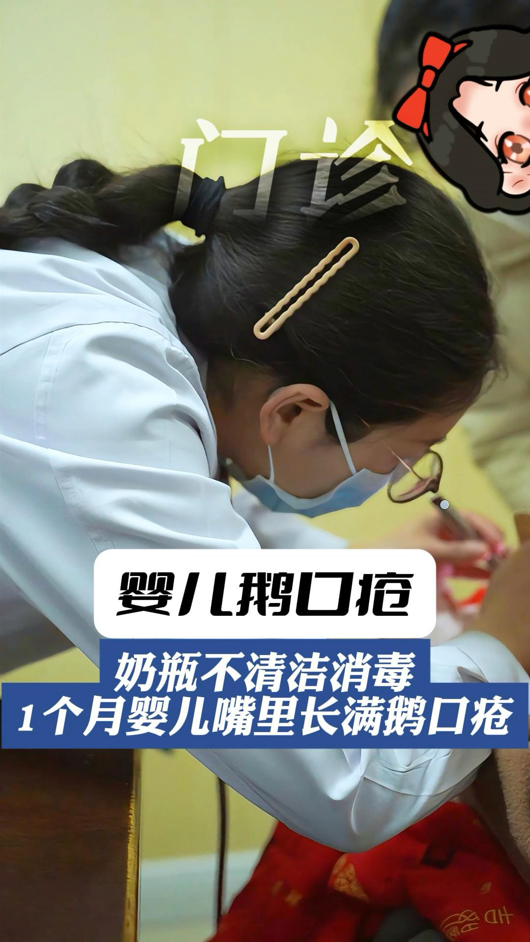 一个多月婴儿,满嘴鹅口疮,罪魁祸首竟是不清洁的奶瓶!