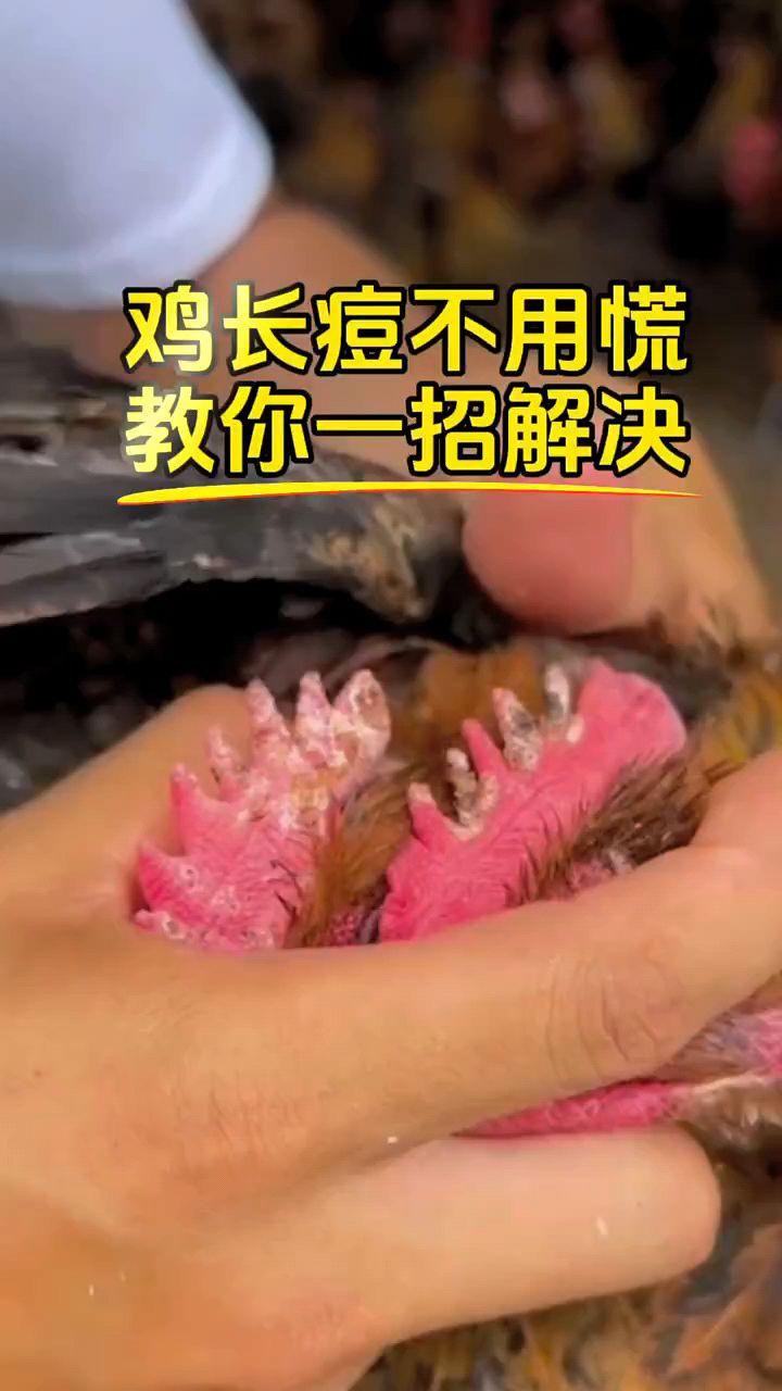 鸡都是痘痘怎么办啊