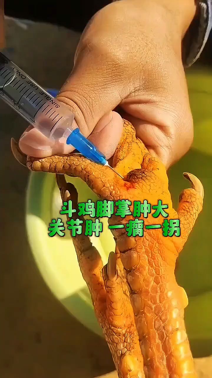 斗鸡脚肿腿瘸瘫痪