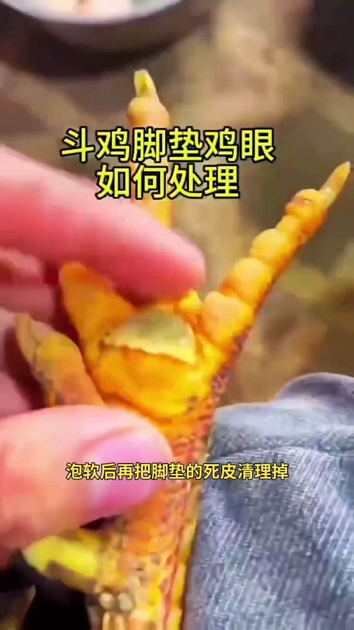 斗鸡脚垫鸡眼如何解决?