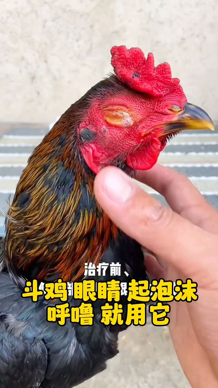 鸡眼肿起泡怎么办