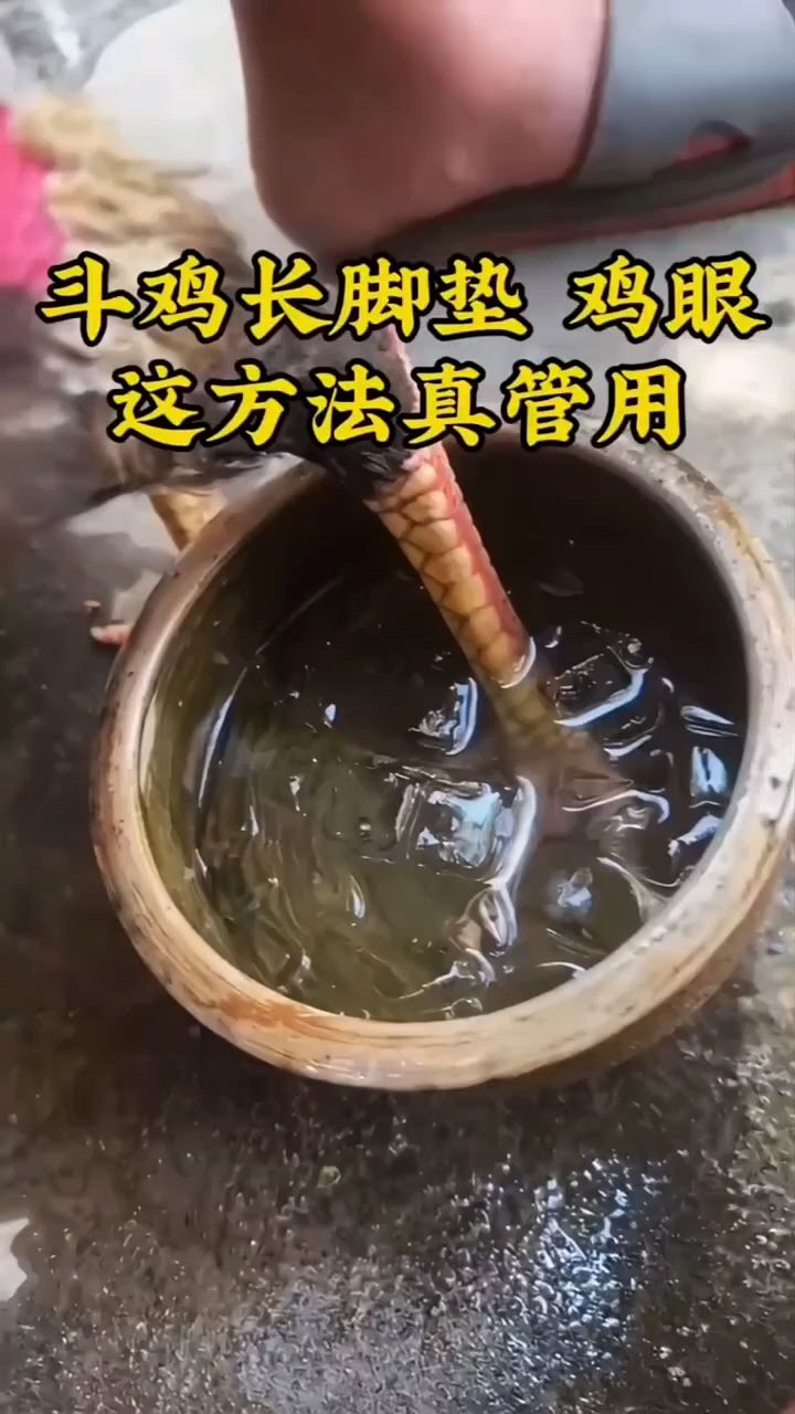 斗鸡脚垫厚长鸡眼