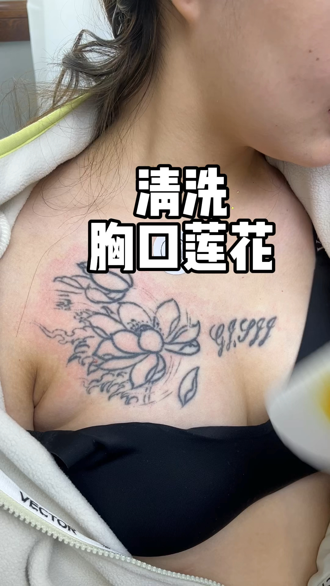 清洗胸口莲花纹身