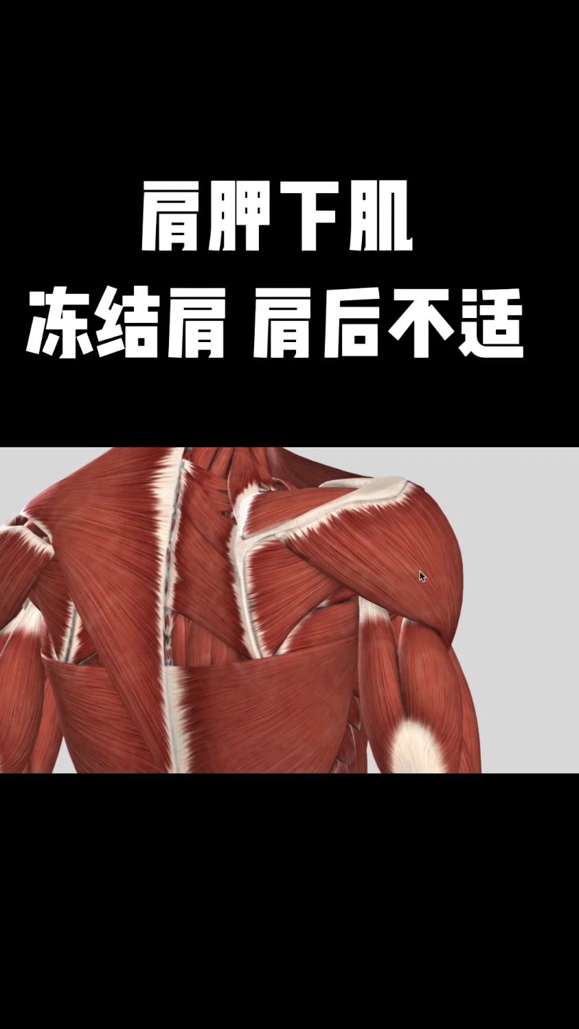 肩后不适一定要检查的肌肉肩胛下肌!