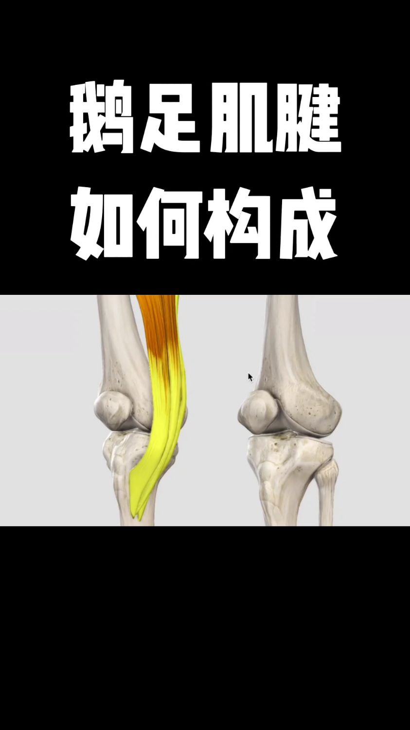 鹅足肌腱如何构成的，你学会了吗？