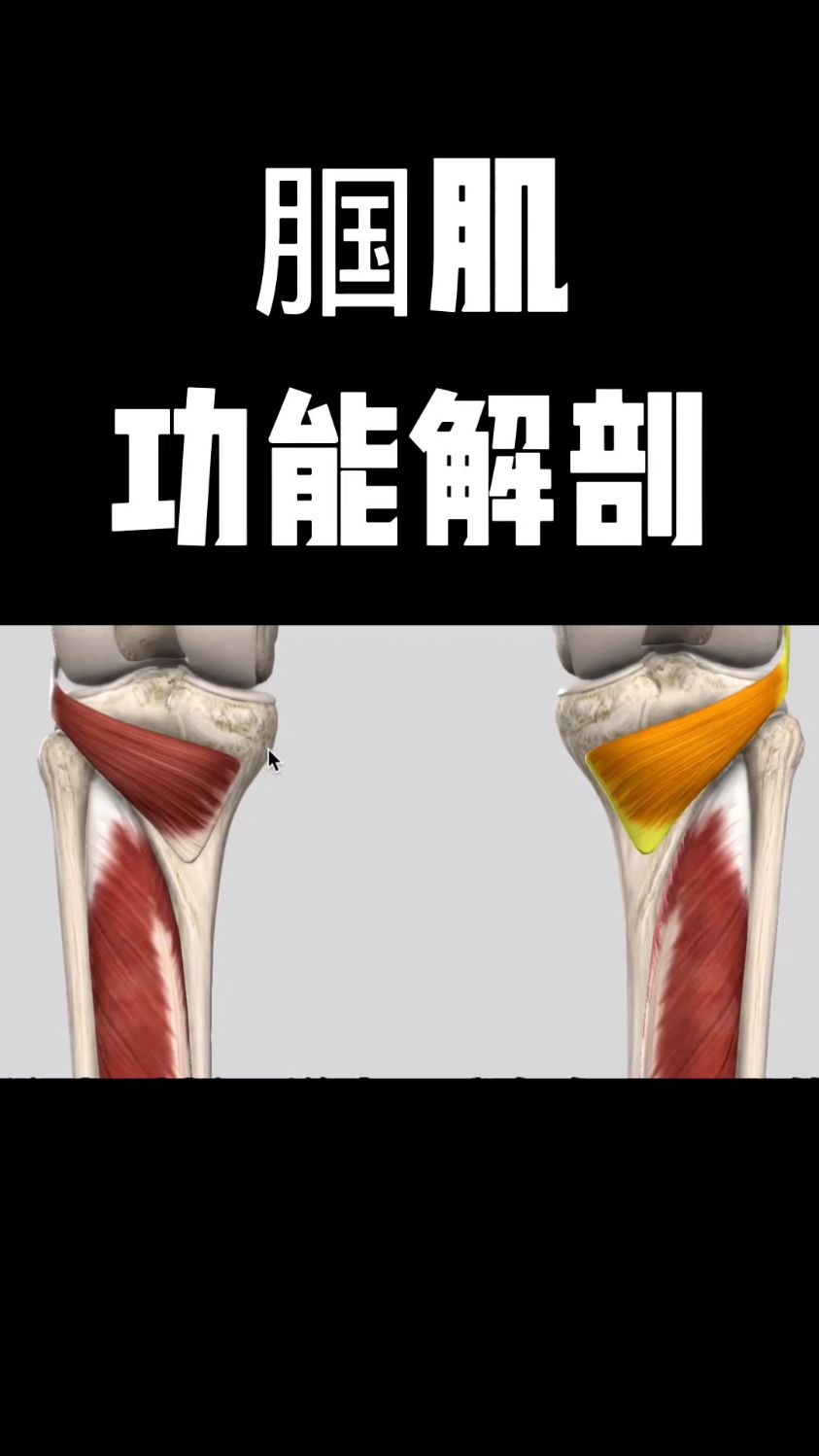 腘肌功能解剖,你学会了吗?