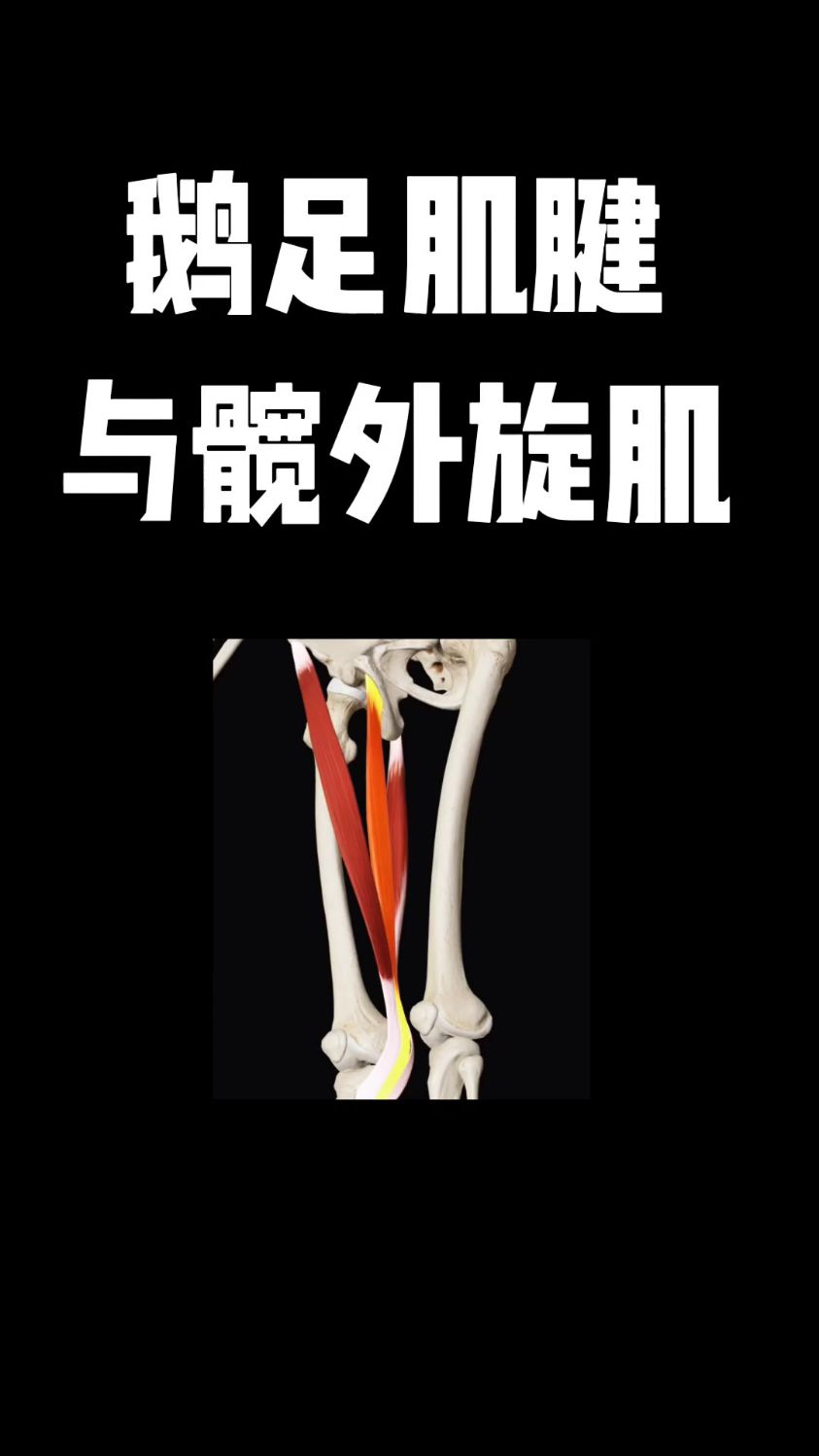 鹅足肌腱与髋外旋肌!