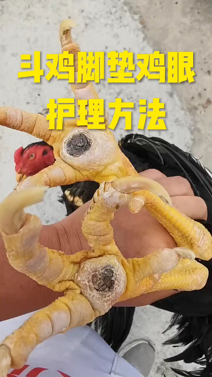 斗鸡脚垫鸡眼护理方法