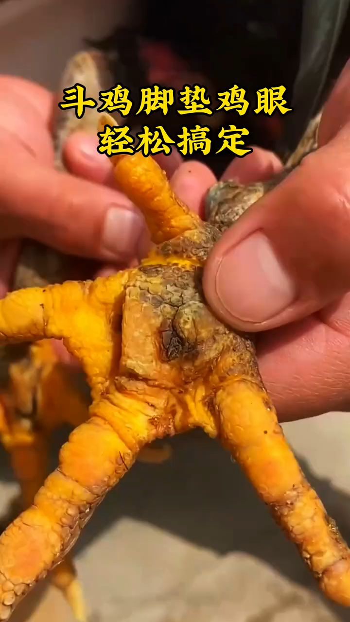 斗鸡脚垫鸡眼，轻松搞定