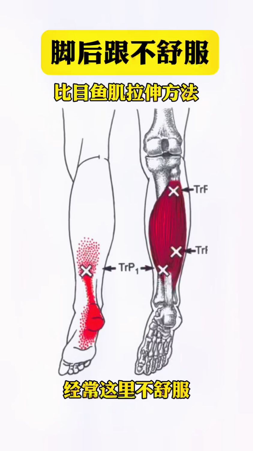 脚后跟不舒服这样子锻炼