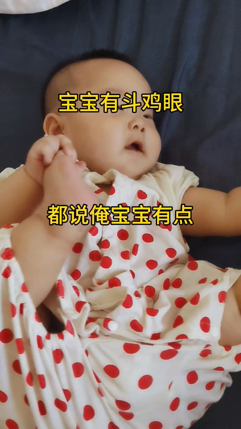 宝宝五个月,被说有斗鸡眼!大家看看有吗?