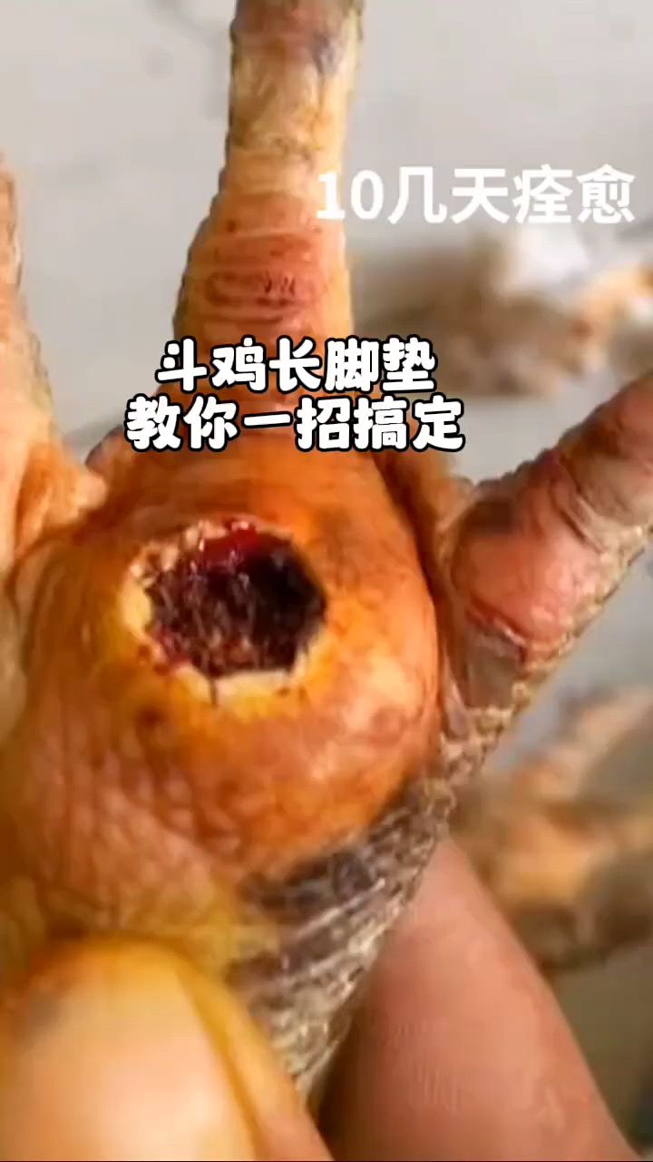 斗鸡脚垫鸡眼怎么处理
