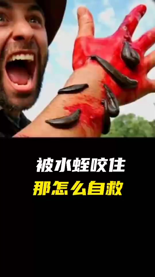 每日科普：水蛭咬住，应该如何快速自救 