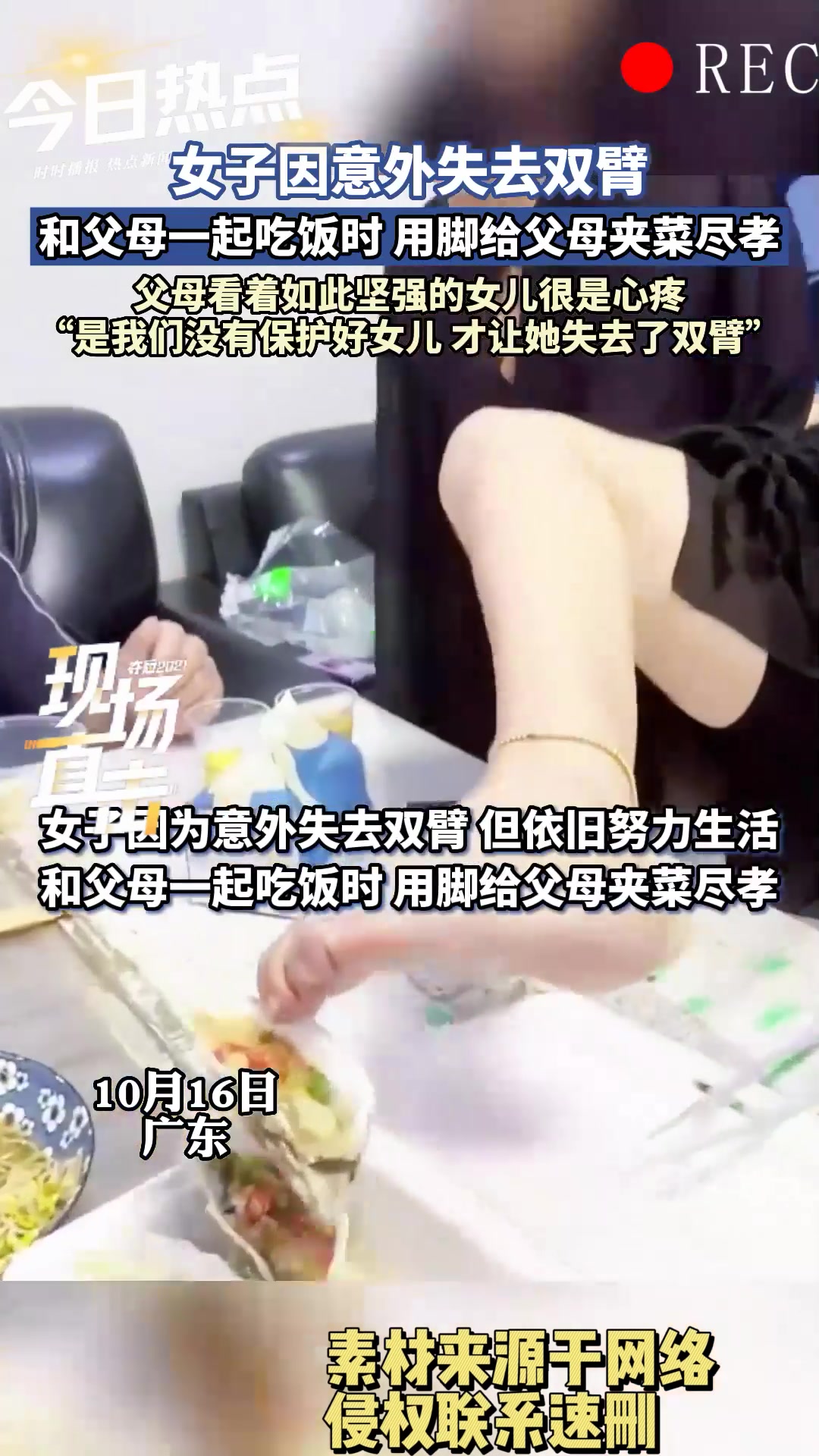 女子意外失去双臂，但她哪怕用脚也要给父母尽孝，善良刻在骨子里