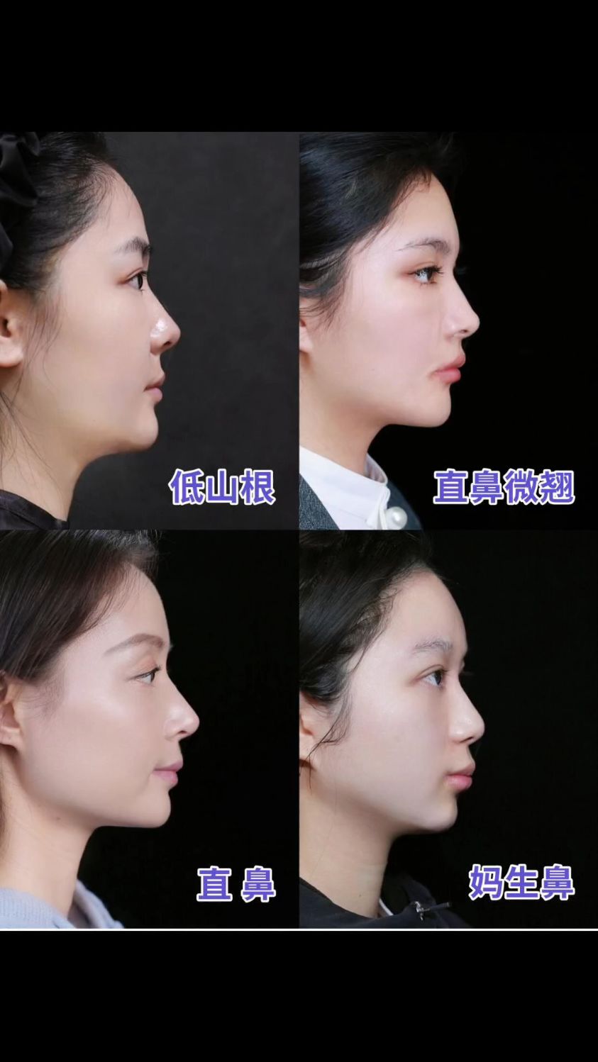 4种热门鼻型模板哪种和你适配度高?