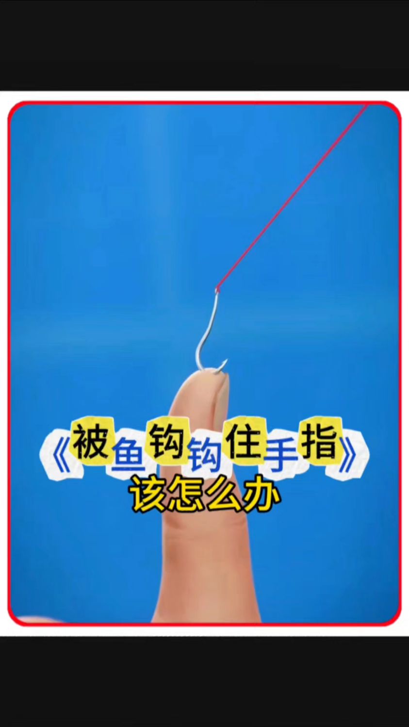 被鱼钩钩住手指怎么办