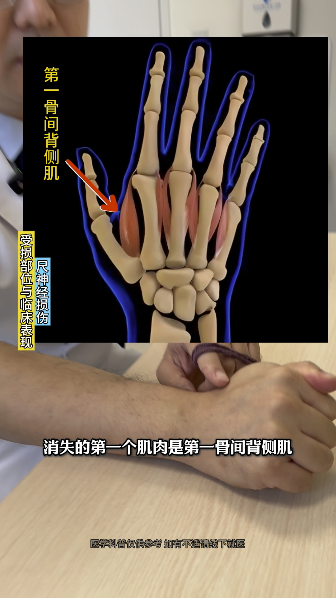 尺神经受损的临床表现