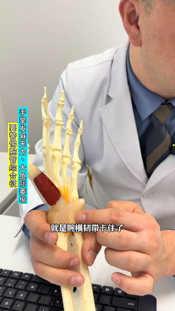 手掌发麻、大鱼际肌肉萎缩警惕腕管综合征