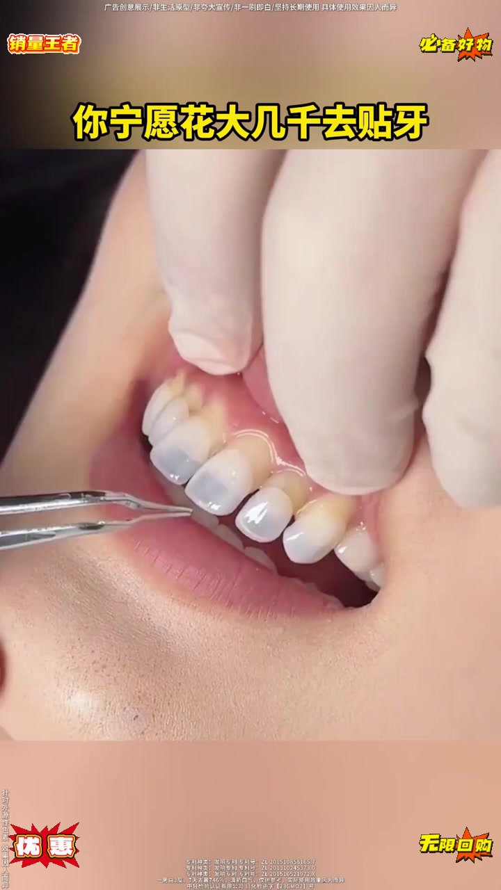 咖啡奶茶不离手，牙黄姐妹快来试试这个牙膏！！真的不会让你失望！！