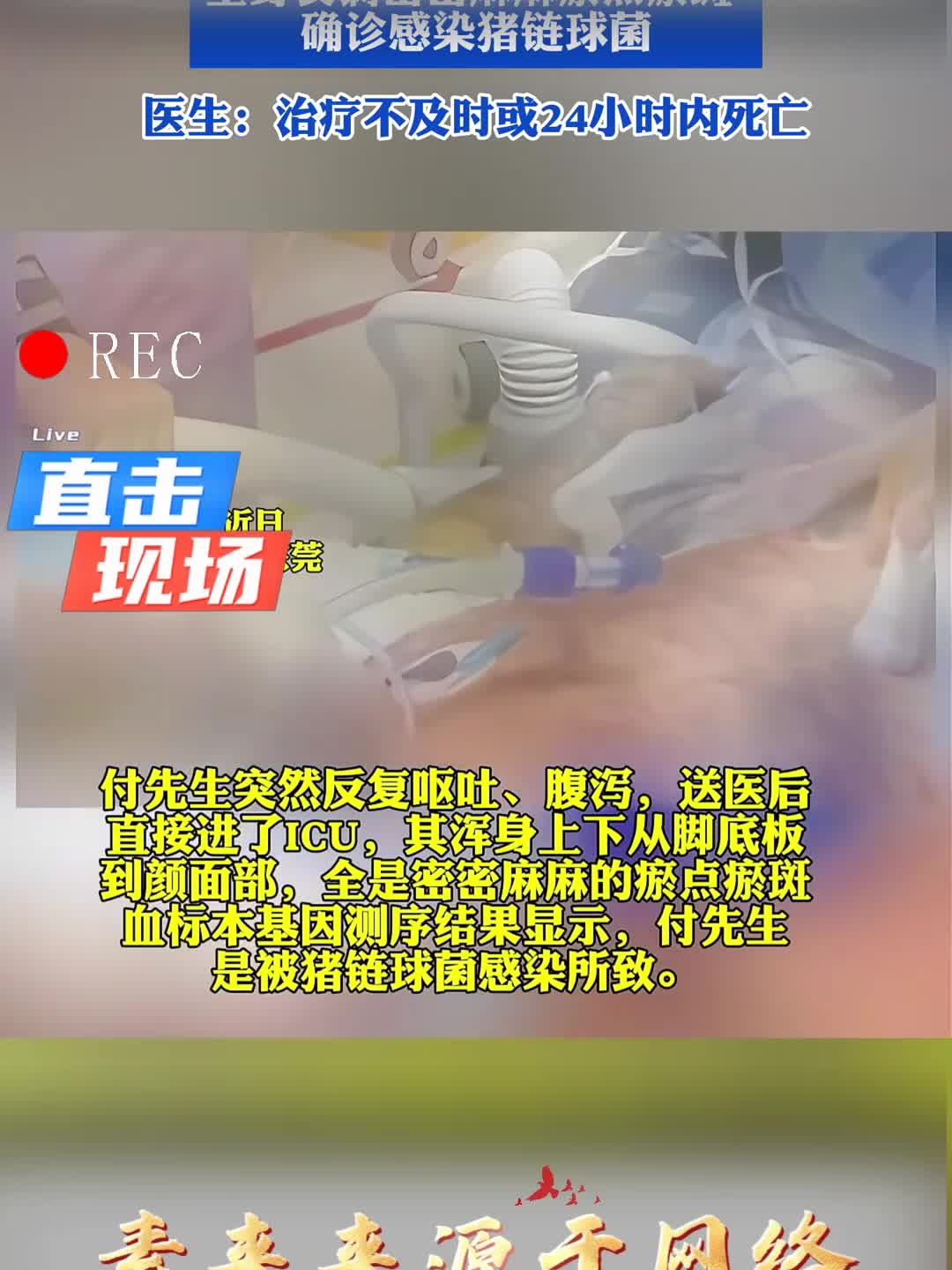 男子带伤切猪肉后呕吐晕倒，全身长满密密麻麻瘀点瘀斑