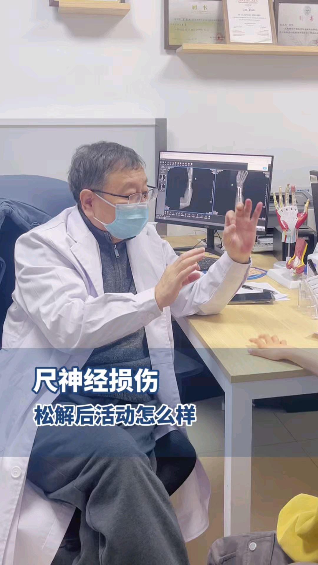 被玻璃划伤，尺神经受损 积水潭张友乐教授 #医生摇人 #骨科