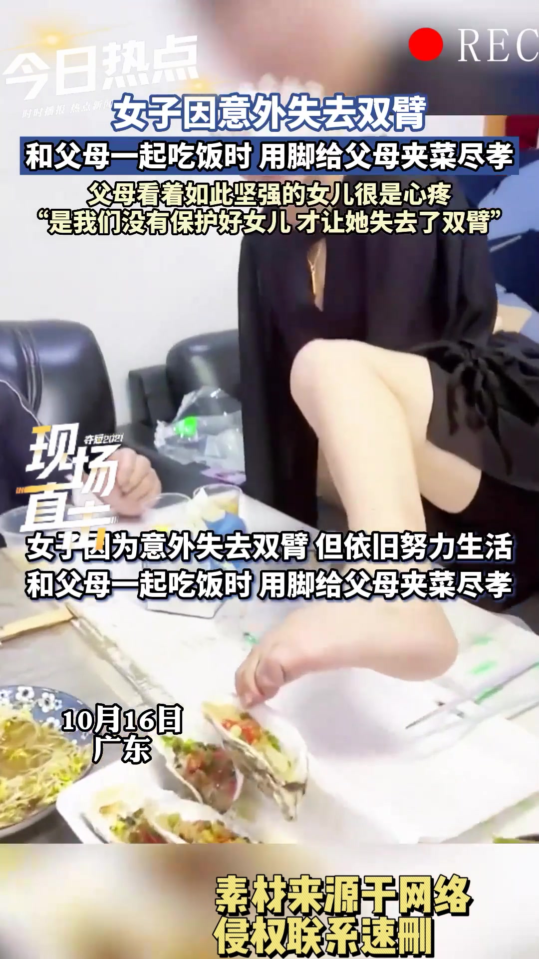 女子意外失去双臂，但她哪怕用脚也要给父母尽孝，善良刻在骨子里