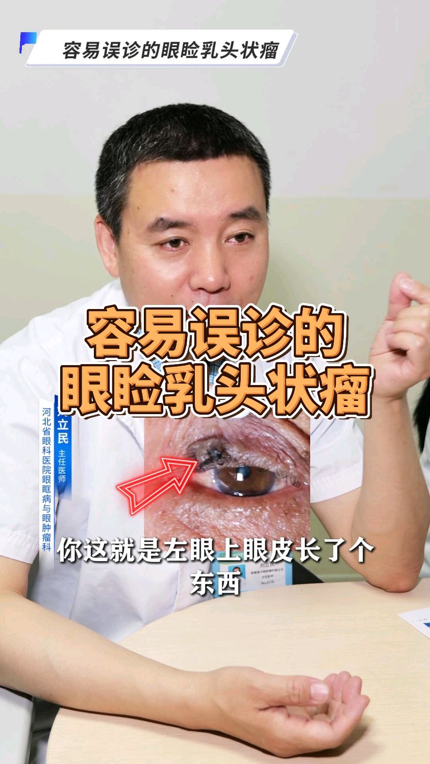 容易误诊的眼睑乳头状瘤