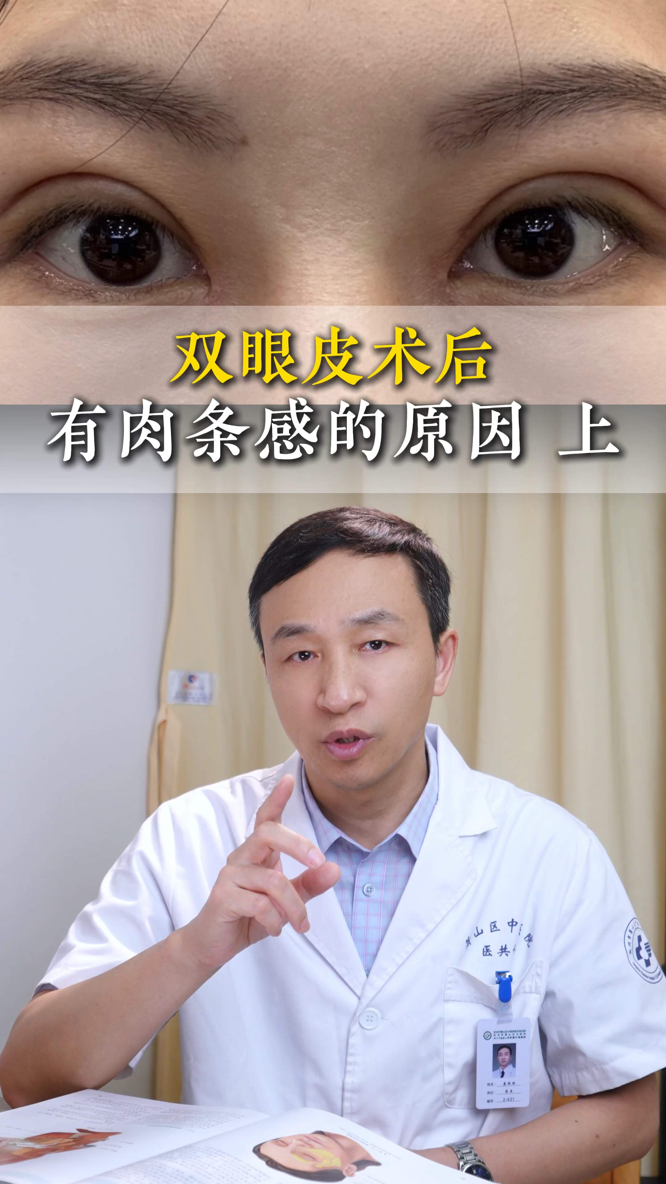 知道为什么你双眼皮术后有肉条感吗?(上)