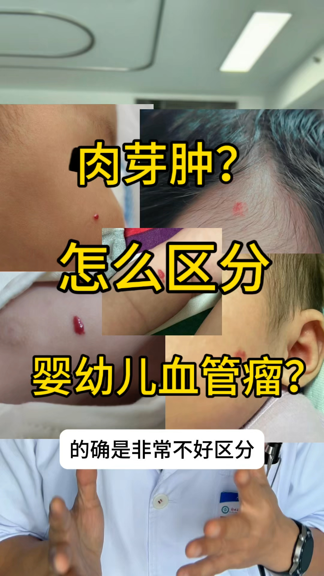 皮肤上的小红点一直出血，可能是肉芽肿