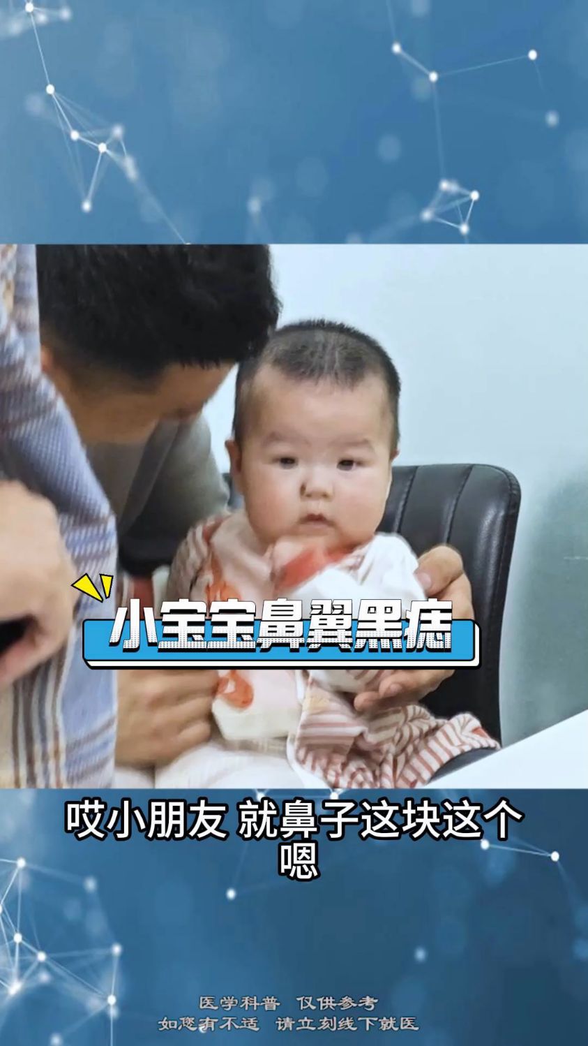 小宝宝鼻翼黑痣 #胎记 #黑痣 #黑毛痣