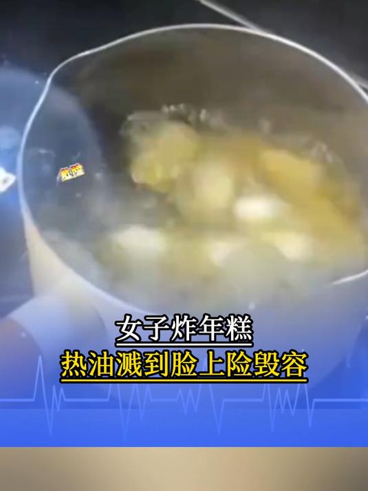 女子炸年糕热油溅到脸上险毁容,被烫伤后紧急冰敷,目前好很多