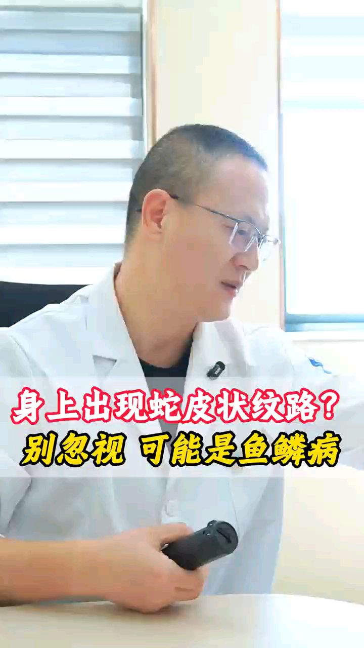 身体出现“蛇皮纹路”,警惕鱼鳞病#鱼鳞病#皮肤科徐永平主任