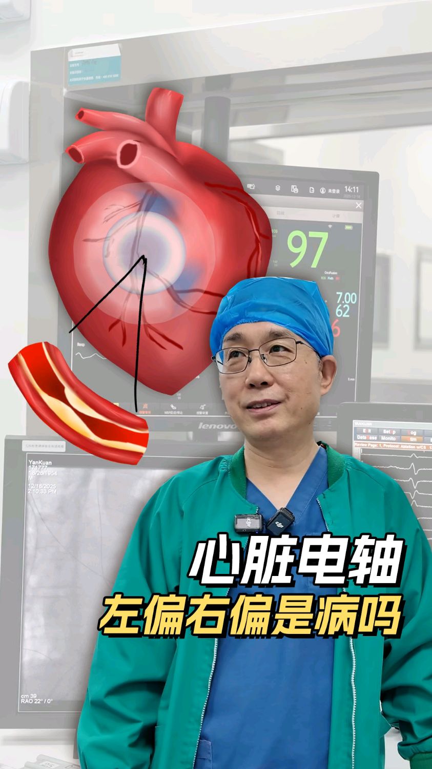 体检心电图报告显示电轴偏移是怎么回事