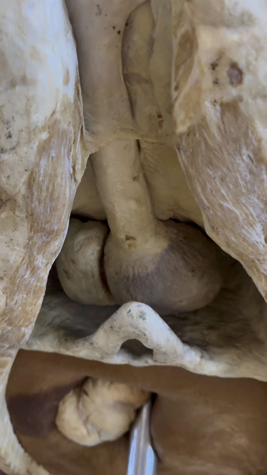 鲸鲨是最大的鱼类，看看鱼类的心脏长啥样，真的和我们人类不一样