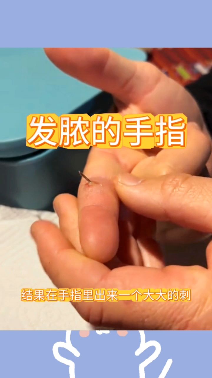 发脓的手指,里面有根刺