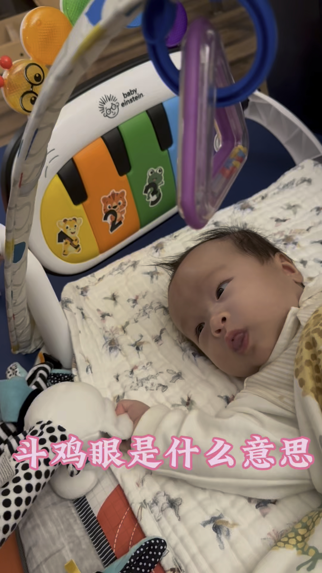斗鸡眼是什么意思啊