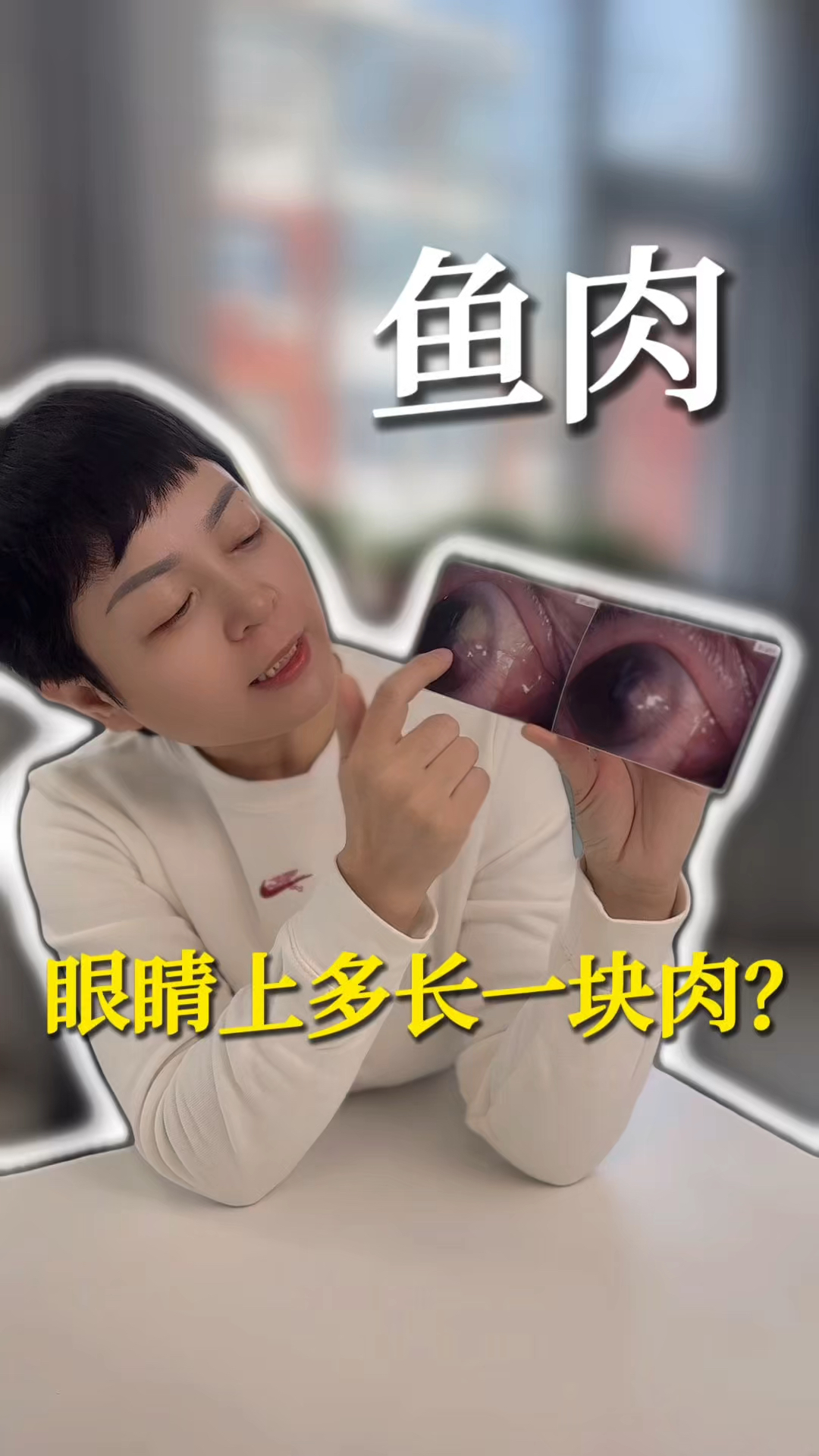 谁的眼睛上多长了一块肉?