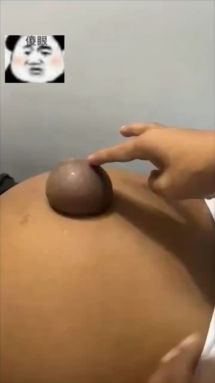 肚子上竟然长出个气球，这是得了什么怪病？ #表情包 #有点搞笑