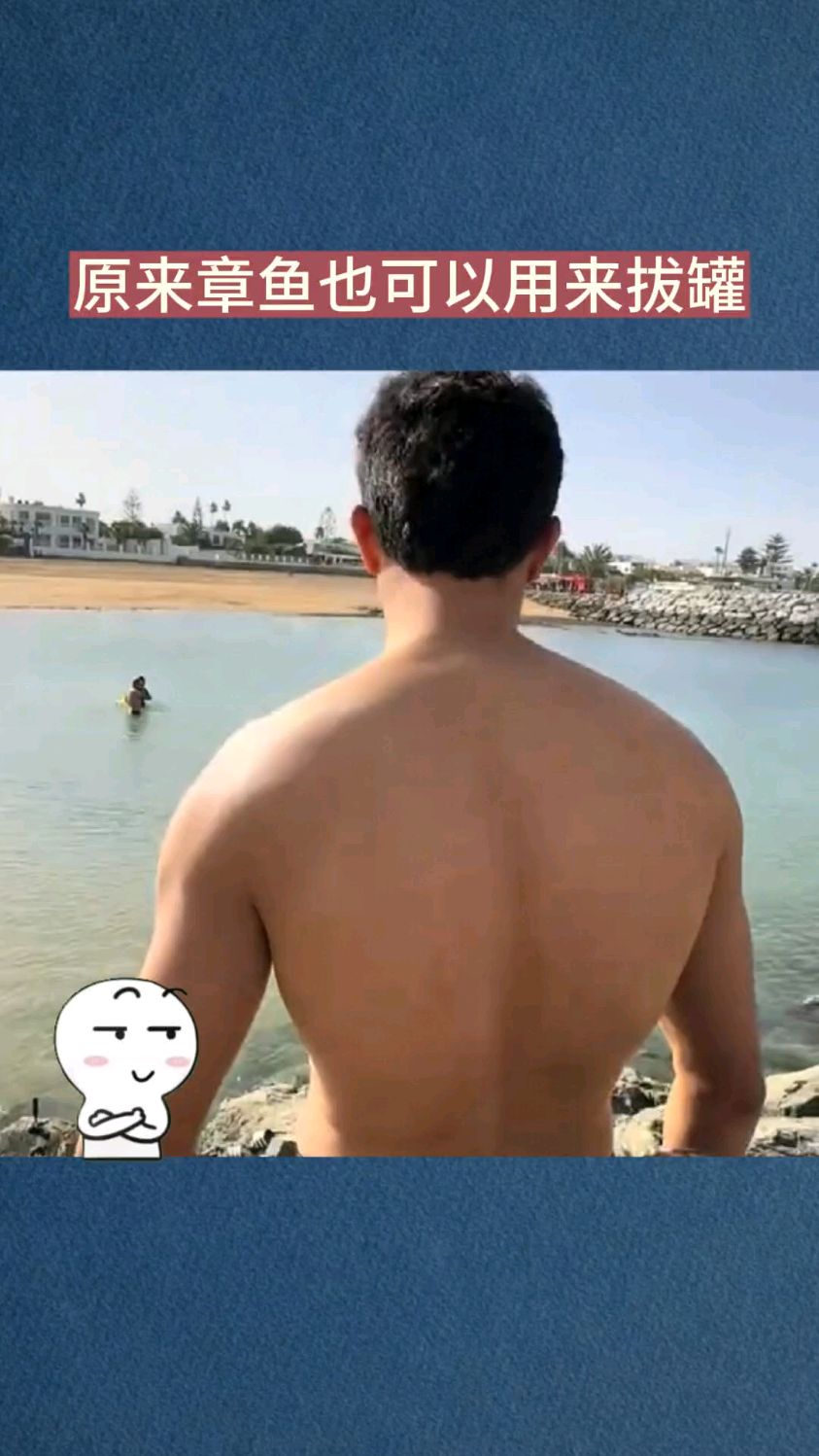 原来章鱼也可以用来拔罐