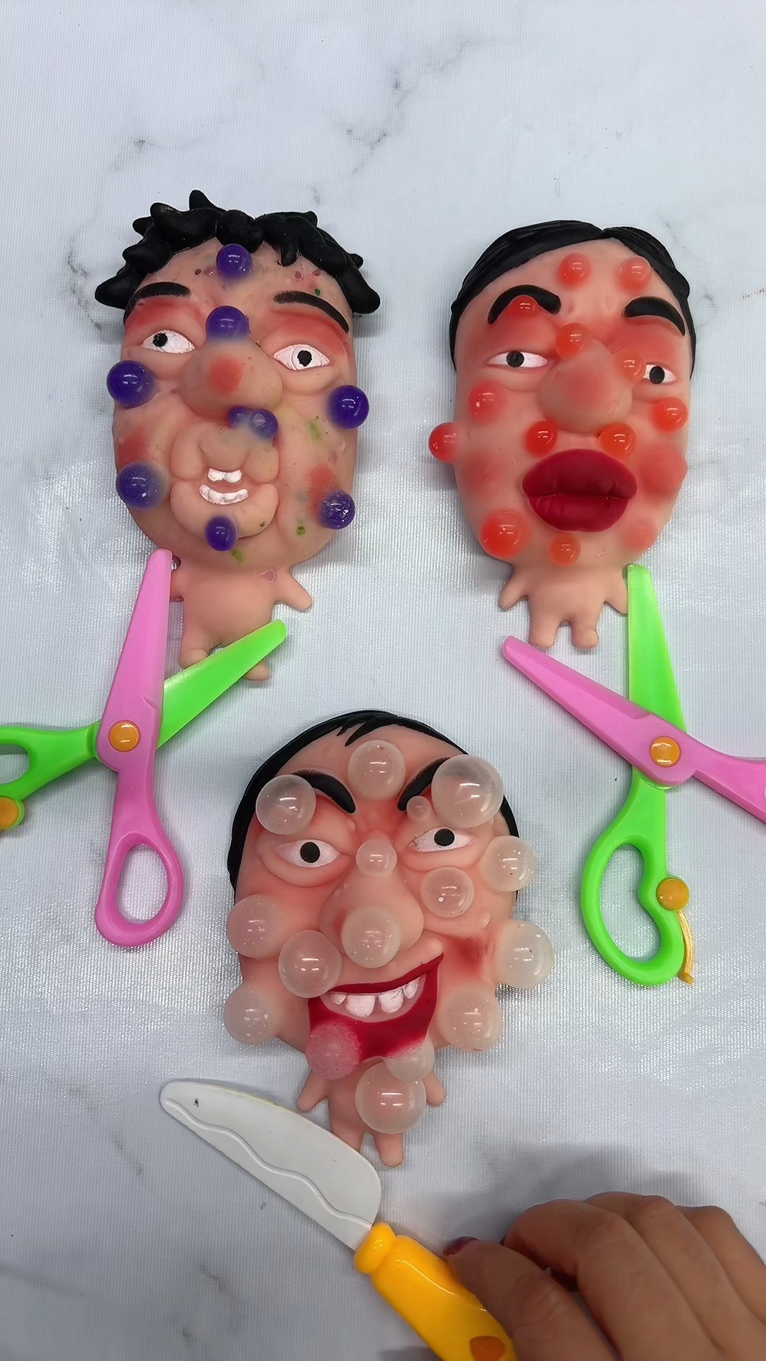 脸上怎么起痘痘了呢?